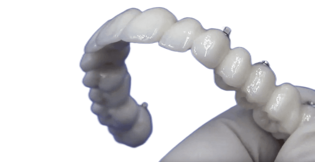PROTESI_DENTALE_CIRCOLARE_CERAMICA_SENZA_FALSA_GENGIVA_ANCHE_PER_PAZIENTI_SENZA_OSSO
